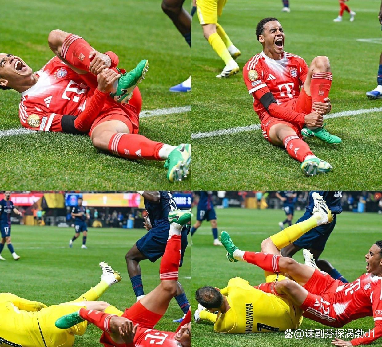 中国熊猫体育-尤文图斯大将赛前受伤，球队战线或受影响的简单介绍